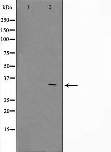 ZNF498 Antibody - Western blot analysis on COS7 cell lysates using ZNF498 antibody. The lane on the left is treated with the antigen-specific peptide.