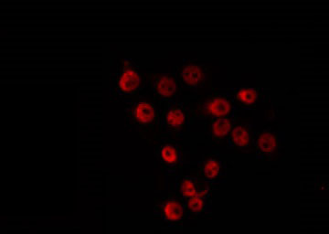 ZNF498 Antibody - Staining COS7 cells by IF/ICC. The samples were fixed with PFA and permeabilized in 0.1% Triton X-100, then blocked in 10% serum for 45 min at 25°C. The primary antibody was diluted at 1:200 and incubated with the sample for 1 hour at 37°C. An Alexa Fluor 594 conjugated goat anti-rabbit IgG (H+L) Ab, diluted at 1/600, was used as the secondary antibody.