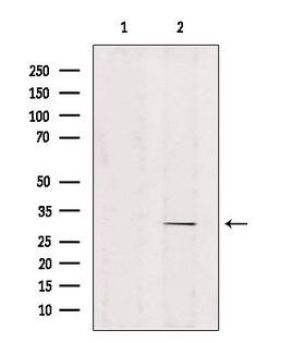 ZNF498 Antibody - Western blot analysis of extracts of mouse brain tissue using ZNF498 antibody. Lane 1 was treated with the blocking peptide.