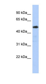 ZNF498 Antibody - ZNF498 antibody Western blot of Jurkat lysate. This image was taken for the unconjugated form of this product. Other forms have not been tested.