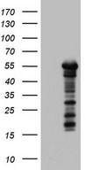 ZNF500 Antibody - HEK293T cells were transfected with the pCMV6-ENTRY control (Left lane) or pCMV6-ENTRY ZNF500 (Right lane) cDNA for 48 hrs and lysed. Equivalent amounts of cell lysates (5 ug per lane) were separated by SDS-PAGE and immunoblotted with anti-ZNF500.