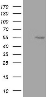 ZNF500 Antibody - HEK293T cells were transfected with the pCMV6-ENTRY control (Left lane) or pCMV6-ENTRY ZNF500 (Right lane) cDNA for 48 hrs and lysed. Equivalent amounts of cell lysates (5 ug per lane) were separated by SDS-PAGE and immunoblotted with anti-ZNF500.