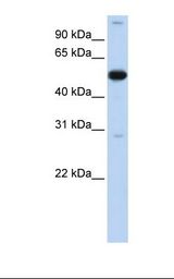 ZNF500 Antibody - Fetal muscle lysate. Antibody concentration: 1.0 ug/ml. Gel concentration: 12%.  This image was taken for the unconjugated form of this product. Other forms have not been tested.