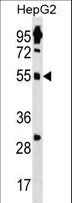 ZNF500 Antibody - ZNF500 Antibody western blot of HepG2 cell line lysates (35 ug/lane). The ZNF500 antibody detected the ZNF500 protein (arrow).