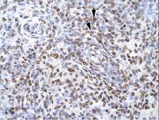 ZNF500 Antibody - ZNF500 antibody ARP31852_P050-NP_067678-ZNF500 (zinc finger protein 500) Antibody was used in IHC to stain formalin-fixed, paraffin-embedded human spleen.  This image was taken for the unconjugated form of this product. Other forms have not been tested.