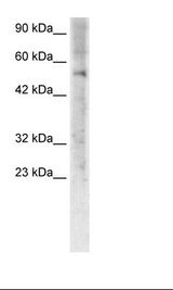 ZNF500 Antibody - Jurkat Cell Lysate.  This image was taken for the unconjugated form of this product. Other forms have not been tested.