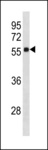 ZNF502 Antibody - ZNF502 Antibody western blot of human placenta tissue lysates (35 ug/lane). The ZNF502 antibody detected the ZNF502 protein (arrow).