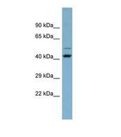 ZNF506 Antibody - Western blot of Human THP-1. ZNF506 antibody dilution 1.0 ug/ml.  This image was taken for the unconjugated form of this product. Other forms have not been tested.