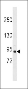 ZNF509 / ZBTB49 Antibody - ZBTB49 Antibody western blot of MDA-MB453 cell line lysates (35 ug/lane). The ZBTB49 antibody detected the ZBTB49 protein (arrow).