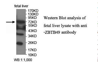 ZNF509 / ZBTB49 Antibody