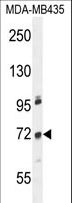 ZNF510 Antibody - ZNF510 Antibody western blot of MDA-MB435 cell line lysates (35 ug/lane). The ZNF510 antibody detected the ZNF510 protein (arrow).