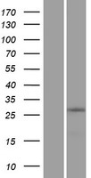 ZNF511 Protein - Western validation with an anti-DDK antibody * L: Control HEK293 lysate R: Over-expression lysate
