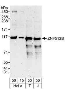 ZNF512B Antibody - Detection of Human ZNF512B by Western Blot. Samples: Whole cell lysate from HeLa (15 and 50 ug), 293T (T; 50 ug) and Jurkat (J; 50 ug) cells. Antibodies: Affinity purified rabbit anti-ZNF512B antibody used for WB at 0.1 ug/ml. Detection: Chemiluminescence with an exposure time of 3 minutes.
