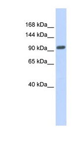ZNF512B Antibody - ZNF512B antibody Western blot of Placenta lysate. This image was taken for the unconjugated form of this product. Other forms have not been tested.