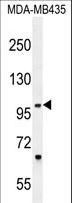 ZNF512B Antibody - ZNF512B Antibody western blot of MDA-MB435 cell line lysates (35 ug/lane). The ZNF512B antibody detected the ZNF512B protein (arrow).