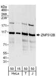 ZNF512B Antibody - Detection of Human ZNF512B by Western Blot. Samples: Whole cell lysate from HeLa (15 and 50 ug), 293T (T; 50 ug) and Jurkat (J; 50 ug) cells. Antibodies: Affinity purified rabbit anti-ZNF512B antibody used for WB at 0.1 ug/ml. Detection: Chemiluminescence with an exposure time of 3 minutes.