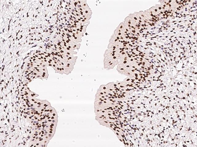 ZNF512B Antibody - Immunochemical staining of human ZNF512B in human urinary bladder with rabbit polyclonal antibody at 1:500 dilution, formalin-fixed paraffin embedded sections.