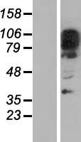 ZNF512B Protein - Western validation with an anti-DDK antibody * L: Control HEK293 lysate R: Over-expression lysate