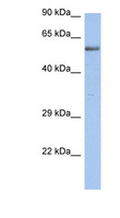 ZNF513 Antibody - ZNF513 antibody Western blot of Fetal Kidney lysate. This image was taken for the unconjugated form of this product. Other forms have not been tested.