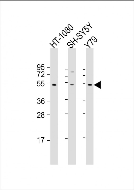 ZNF513 Antibody - All lanes: Anti-ZNF513 Antibody (N-Term) at 1:2000 dilution. Lane 1: HT-1080 whole cell lysate. Lane 2: SH-SY5Y whole cell lysate. Lane 3: Y79 whole cell lysate Lysates/proteins at 20 ug per lane. Secondary Goat Anti-Rabbit IgG, (H+L), Peroxidase conjugated at 1:10000 dilution. Predicted band size: 58 kDa. Blocking/Dilution buffer: 5% NFDM/TBST.
