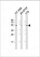 ZNF513 Antibody - All lanes: Anti-ZNF513 Antibody (N-Term) at 1:2000 dilution. Lane 1: HT-1080 whole cell lysate. Lane 2: SH-SY5Y whole cell lysate. Lane 3: Y79 whole cell lysate Lysates/proteins at 20 ug per lane. Secondary Goat Anti-Rabbit IgG, (H+L), Peroxidase conjugated at 1:10000 dilution. Predicted band size: 58 kDa. Blocking/Dilution buffer: 5% NFDM/TBST.