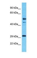 ZNF514 Antibody - Western blot of ZNF514 Antibody with human Thymus Tumor lysate.  This image was taken for the unconjugated form of this product. Other forms have not been tested.