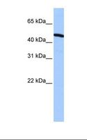 ZNF514 Antibody - Hela cell lysate. Antibody concentration: 0.5 ug/ml. Gel concentration: 12%.  This image was taken for the unconjugated form of this product. Other forms have not been tested.