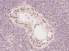 ZNF516 Antibody - Immunochemical staining of human ZNF516 in human testis with rabbit polyclonal antibody at 1:100 dilution, formalin-fixed paraffin embedded sections.