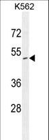 ZNF517 Antibody - ZNF517 Antibody western blot of K562 cell line lysates (35 ug/lane). The ZNF517 antibody detected the ZNF517 protein (arrow).