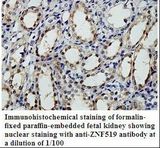 ZNF519 Antibody