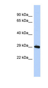 ZNF524 Antibody - ZNF524 antibody Western blot of MCF7 cell lysate. This image was taken for the unconjugated form of this product. Other forms have not been tested.