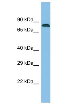 ZNF526 Antibody - ZNF526 antibody Western Blot of Fetal Kidney. Antibody dilution: 1 ug/ml.  This image was taken for the unconjugated form of this product. Other forms have not been tested.