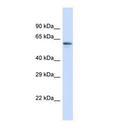 ZNF527 Antibody - Western blot of Human Placenta. ZNF527 antibody dilution 1.0 ug/ml.  This image was taken for the unconjugated form of this product. Other forms have not been tested.
