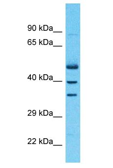 ZNF528 Antibody - ZNF528 antibody Western Blot of Uterus Tumor. Antibody dilution: 1 ug/ml.  This image was taken for the unconjugated form of this product. Other forms have not been tested.