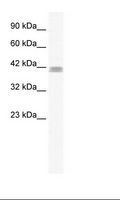 ZNF529 Antibody - Jurkat Cell Lysate.  This image was taken for the unconjugated form of this product. Other forms have not been tested.