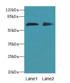 ZNF529 Antibody - Western blot. All lanes: ZNF529 antibody at 6 ug/ml. Lane 1: HeLa whole cell lysate. Lane 2: MCF7 whole cell lysate. Secondary Goat polyclonal to Rabbit IgG at 1:10000 dilution. Predicted band size: 66 kDa. Observed band size: 66 kDa.