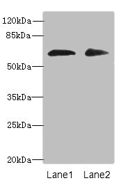 ZNF529 Antibody - Western blot All lanes: ZNF529 antibody at 6µg/ml Lane 1: Hela whole cell lysate Lane 2: MCF-7 whole cell lysate Secondary Goat polyclonal to rabbit IgG at 1/10000 dilution Predicted band size: 66 kDa Observed band size: 66 kDa