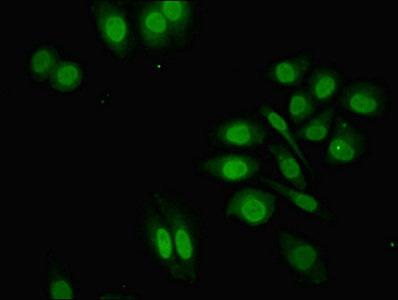 ZNF529 Antibody - Immunofluorescent analysis of A549 cells using ZNF529 Antibody at dilution of 1:100 and Alexa Fluor 488-congugated AffiniPure Goat Anti-Rabbit IgG(H+L)