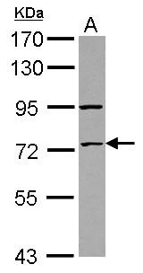 ZNF530 Antibody - Sample (30 ug of whole cell lysate) A: IMR32 7.5% SDS PAGE ZNF530 antibody diluted at 1:1000