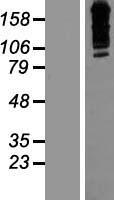ZNF536 Protein - Western validation with an anti-DDK antibody * L: Control HEK293 lysate R: Over-expression lysate