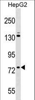 ZNF540 Antibody - ZNF540 Antibody western blot of HepG2 cell line lysates (35 ug/lane). The ZNF540 antibody detected the ZNF540 protein (arrow).