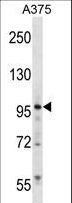 ZNF541 Antibody - ZNF541 Antibody western blot of A375 cell line lysates (35 ug/lane). The ZNF541 antibody detected the ZNF541 protein (arrow).