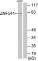ZNF541 Antibody - Western blot analysis of lysates from K562 cells, using ZNF541 Antibody. The lane on the right is blocked with the synthesized peptide.