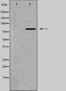 ZNF541 Antibody - Western blot analysis of extracts of K562 cells using ZNF541 antibody. The lane on the left is treated with the antigen-specific peptide.