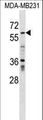 ZNF543 Antibody - ZNF543 Antibody western blot of MDA-MB231 cell line lysates (35 ug/lane). The ZNF543 antibody detected the ZNF543 protein (arrow).