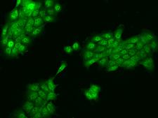 ZNF543 Antibody - Immunofluorescence staining of ZNF543 in A431 cells. Cells were fixed with 4% PFA, permeabilzed with 0.3% Triton X-100 in PBS, blocked with 10% serum, and incubated with rabbit anti-Human ZNF543 polyclonal antibody (dilution ratio 1:100) at 4°C overnight. Then cells were stained with the Alexa Fluor 488-conjugated Goat Anti-rabbit IgG secondary antibody (green). Positive staining was localized to Nucleus and Cytoplasm.