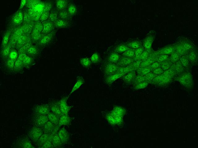 ZNF543 Antibody - Immunofluorescence staining of ZNF543 in A431 cells. Cells were fixed with 4% PFA, permeabilzed with 0.3% Triton X-100 in PBS, blocked with 10% serum, and incubated with rabbit anti-Human ZNF543 polyclonal antibody (dilution ratio 1:100) at 4°C overnight. Then cells were stained with the Alexa Fluor 488-conjugated Goat Anti-rabbit IgG secondary antibody (green). Positive staining was localized to Nucleus and Cytoplasm.