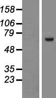 ZNF543 Protein - Western validation with an anti-DDK antibody * L: Control HEK293 lysate R: Over-expression lysate