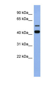 ZNF547 Antibody - ZNF547 antibody Western blot of Fetal Spleen lysate. This image was taken for the unconjugated form of this product. Other forms have not been tested.
