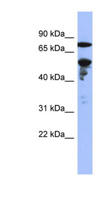 ZNF549 Antibody - ZNF549 antibody Western blot of NCI-H226 cell lysate. This image was taken for the unconjugated form of this product. Other forms have not been tested.
